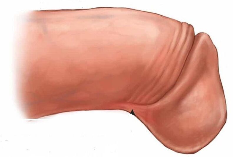 kako povećati glavić penisa